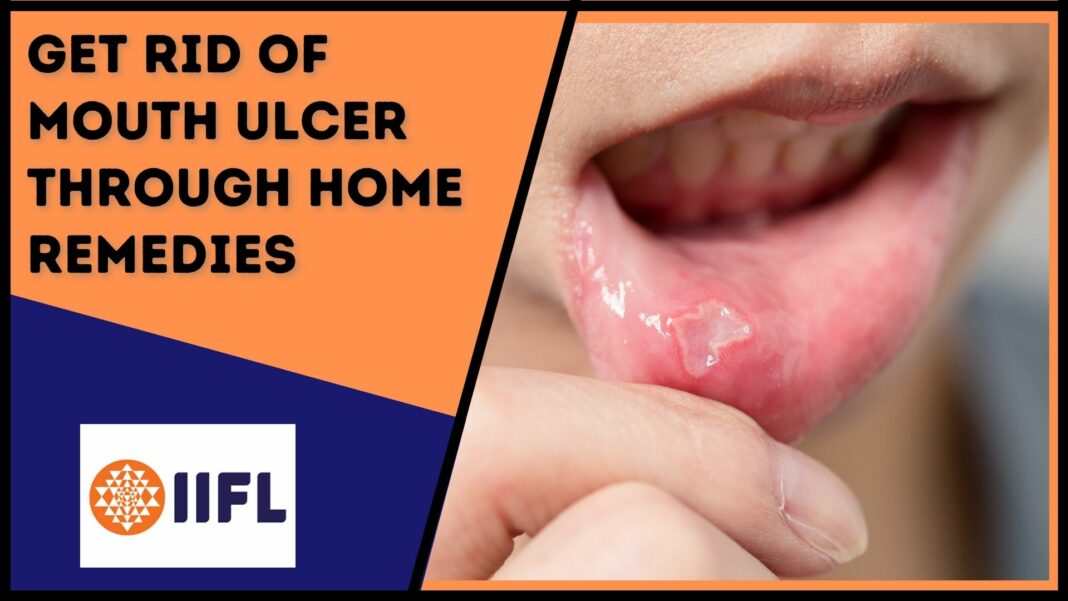 remedies-for-mouth-ulcers-5-best-natural-remedies-for-mouth-ulcers