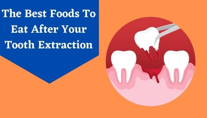 foods to eat after your tooth extraction