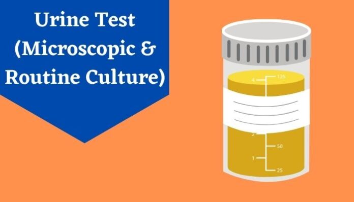 Urine Test (Microscopic & Routine Culture)