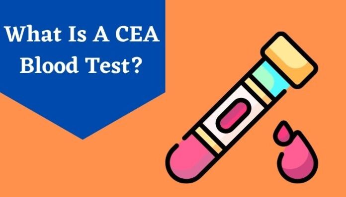 cea-test-purpose-procedure-results-cea-blood-test-test-livlong