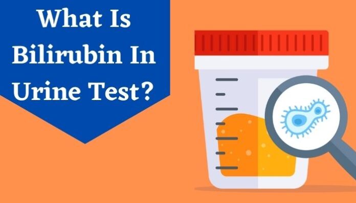 bilirubin in urine test