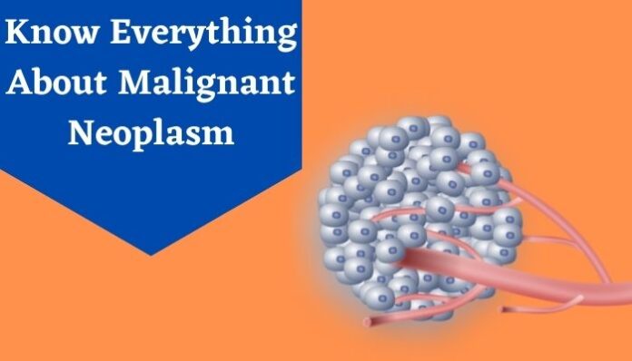 malignant neoplasm