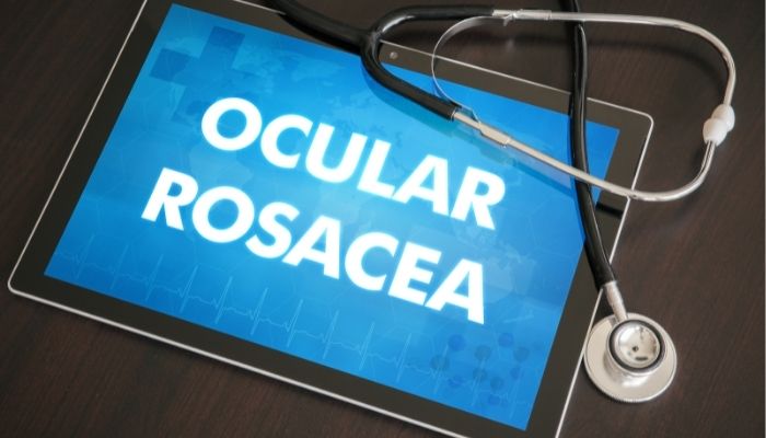 ocular rosacea