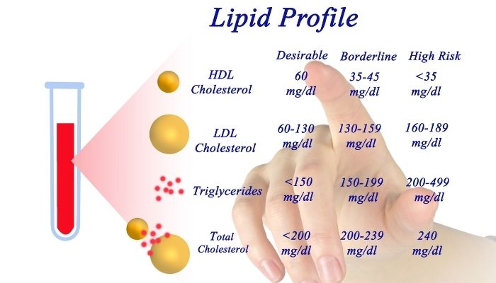 Lipid Profile Test or Lipid Panel