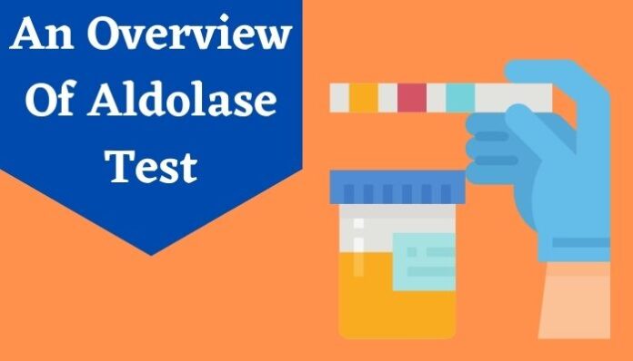 Aldolase test